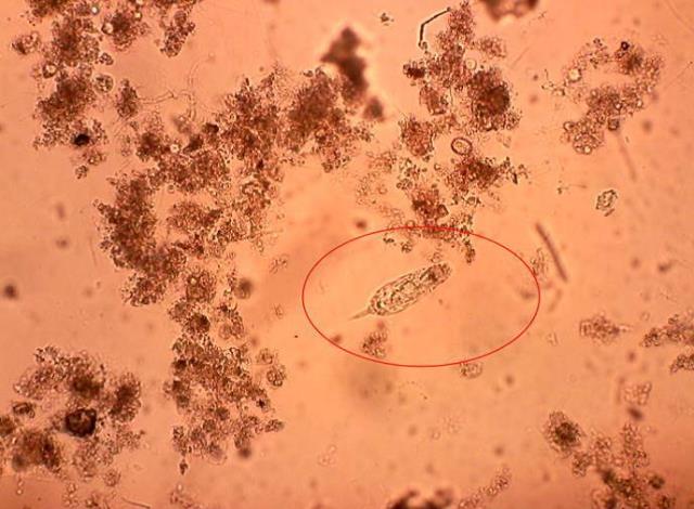 污水處理廠中常見的「益生菌」-狹甲輪蟲