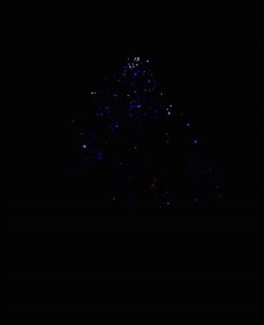 NGC 2264(X光)