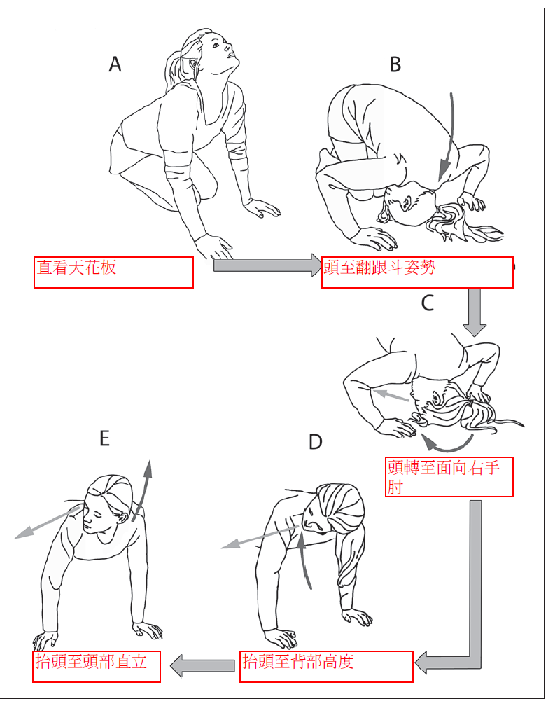 耳石復位法  以半翻跟斗式治療右側耳石脫落(圖片來源為國際期刊Foster et al, Audiol Neurotol Extra 2012;216–23)