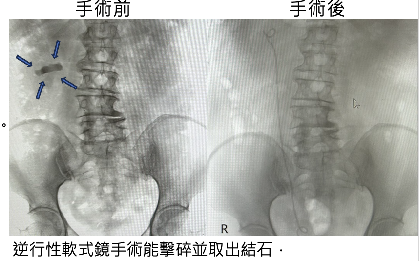 實際使用案例分享(圖片由林嘉緯醫師提供)