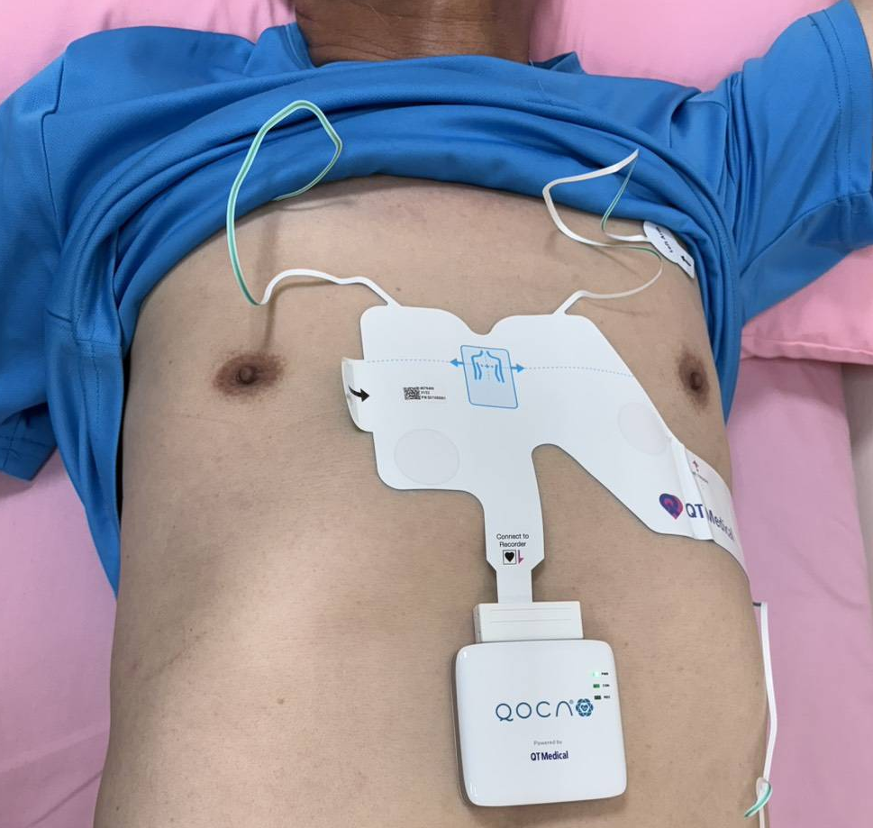 圖二_北市聯醫透過AI心電圖檢測心北竿居民心血管健康，將智慧醫療帶入離島