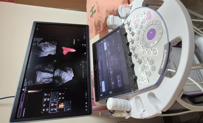 「子宮內膜癌特別門診」提供高風險族群快速掛號  即時檢查服務(照片由婦幼院區提供)