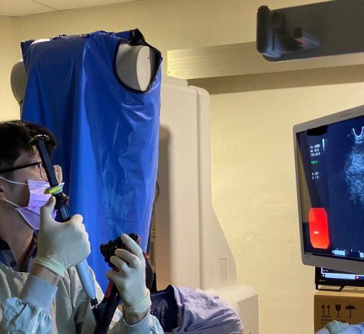 「內視鏡超音波導引下胰臟膿瘍金屬支架引流術」手術示意圖-2(照片由黃柏翰醫師提供)