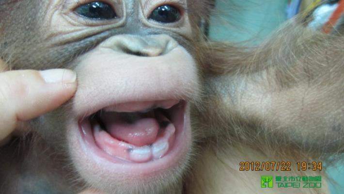 Growing front teeth