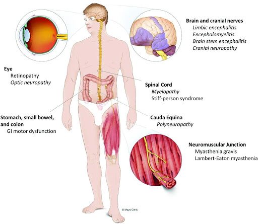 腦或脊髓、周邊神經、視覺系統、神經肌肉交界處及肌肉圖